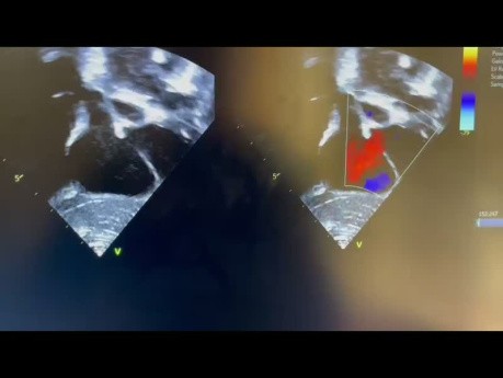 Können Sie den Echokardiographie-Fall erraten?