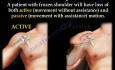 Adhäsive Kapsulitis & Schultersteife