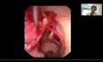 Endoskopische Anatomie des Ohrs