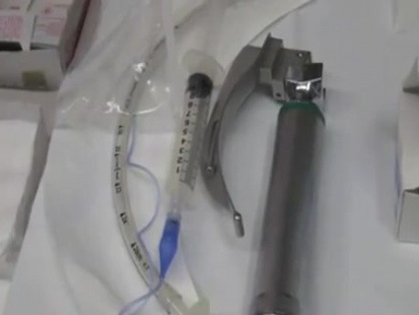 Funktionelle endoskopische Nebenhöhlenoperation - 14-jähriges Mädchen