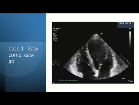 Echokardiographische Beurteilung von Herzmassen – ein systematischer Ansatz durch fallbasiertes Lernen
