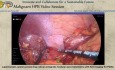 Laparoskopische, milzerhaltende radikale antegraden modulare Pankreatektomie mit ICG-Bildgebung bei PDAC