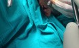 Reduktion des Jochbogens über einem intraoralen Zugang