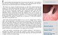Hysteroskopie-Newsletter 2.5