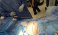 Präventiver Ansatz beim ersten abdominalen Zugang – Vermeidung von Risiken und Zwischenfällen