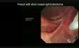 Endoskopische Retrograde Cholangiopankreatikographie (ERCP)