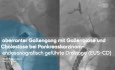 Abberanter Gallengang mit Cholestase