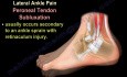 Knöchelschmerzen - Bänder, Verstauchung - Videovortrag