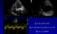 Echokardiographische Messung vom Herzzeitvolumen