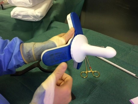 Operation von blutenden und prolabierenden Hämorrhoiden mit einer nicht geschnittenen Technik
