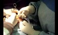 Brustvergrößerung Chirurgie 