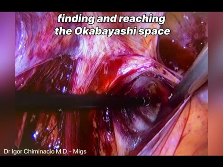 Endometriose-Operation - Wertheim-Okabayashi