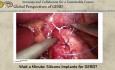 Moment mal – Silikonimplantate zur Behandlung der gastroösophagealen Refluxkrankheit?