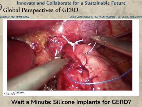 Moment mal – Silikonimplantate zur Behandlung der gastroösophagealen Refluxkrankheit?