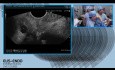 Diagnostische EUS