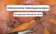 Laparoskopische totale Hysterektomie [Kurzvideo]