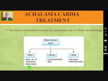 Achalasie Cardia - Dysphagie