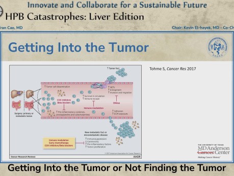In den Tumor hineinschneiden oder den Tumor verfehlen