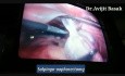 Eierstockzyste mit Komplikationen ( Ovarialtorsion und Adhäsionen)- Laparoskopie
