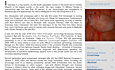 Hysteroskopie: Newsletter 3.1