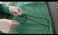Weston Gleitknoten - Laparoskopische Gleitknoten