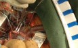Minimalinvasive-Mitralklappenrekonstruktion – direkte Kanülierung