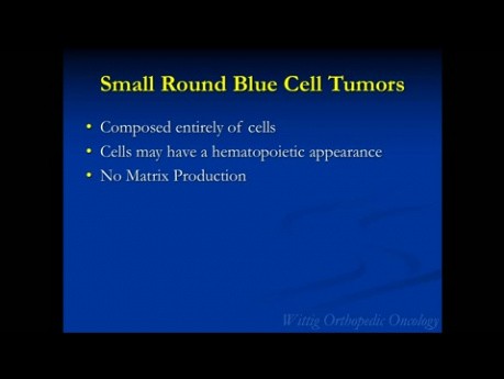 Kurs Orthopädische Onkologie - Kleine blaue rundzellige Tumoren (Ewing-Sarkom, Lymphom) - Vortrag 8