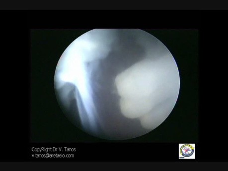 Embryoskopie