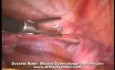  Hypoplasie des Uterus- Laparoskopie
