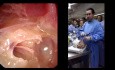 Endoskopische Ohrdissektion - Teil I