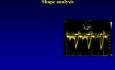  Echokardiographische Messung des Herzzeitvolumens