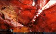 Robotische Bottom-up-TARUP bei >10 cm Rektusdiastase – Inan Inverting Plication