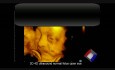 3D 4D-Ultraschallaufnahme von einem normalen Fötus mit geöffneten Augen
