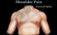 Schulterschmerzen - Anatomie und Untersuchung