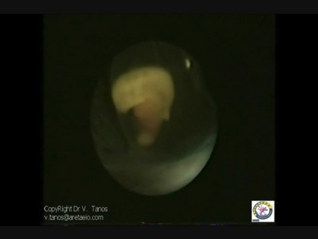 Embryoskopie 3