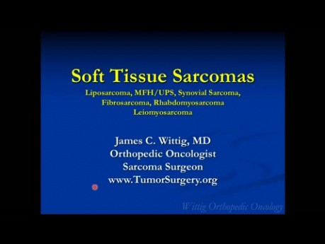 Kurs Orthopädische Onkologie - Weichteilsarkome (Liposarkom, MFH etc.) - Vortrag 10