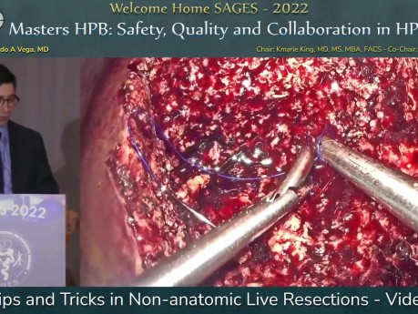 Tipps und Tricks bei nichtanatomischen Leberresektionen