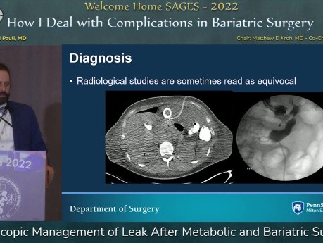 Endoskopisches Management von Leckagen nach metabolischer und bariatrischer Chirurgie