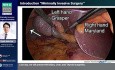 Fertigkeiten in der minimal-invasiven Chirurgie