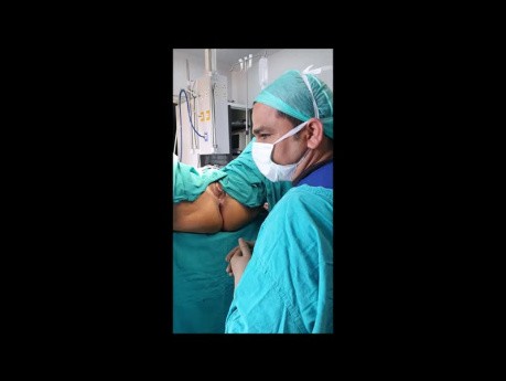 Rekto-vesikale Fistel | Analfistel mit Ausbreitung in rechtem Eierstock