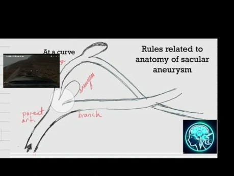 Aneurysma-Regeln