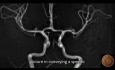 Modifiziertes anatomisches Bild