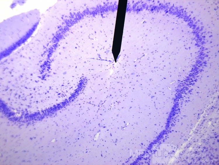 Hippocampusformation