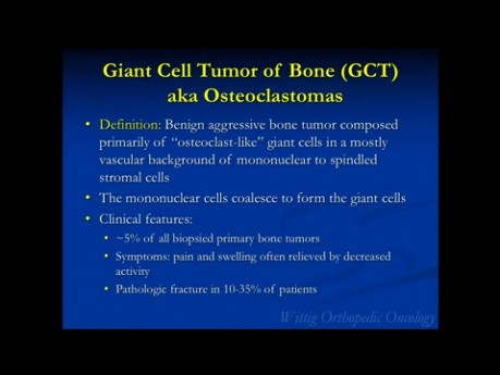 Kurs Orthopädische Onkologie - Strahlendurchlässige Knochenläsionen (GCT, ABC, UBC) - Vortrag 7