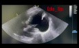 Kardiologie in der Praxis – Was sehen Sie in der Echokardiographie?