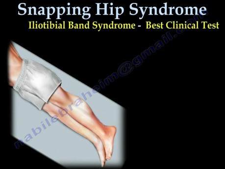 Coxa saltans (snapping hip syndrome) - Videovortrag