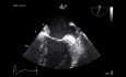 Transösophageale Echokardiographie - Quiz und Überblick über Schnittebenen