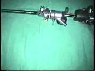 Beschreibung des Resection Master - Resektoskops