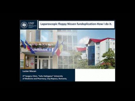 Die laparoskopische Fundoplikation nach Nissen. Wie tue ich das?