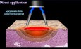 Sichere Anwendung der Elektrochirurgie – ein Überblick
